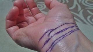 rascette lines in blue pen drawn on wrist