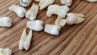 Loose teeth scattered on a table.