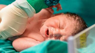 A nurse moving the clip a newborn baby's umbillical cord.