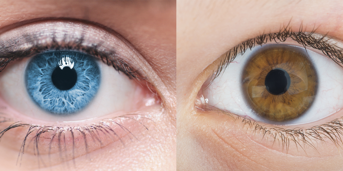 for-5-000-you-can-turn-your-eyes-from-brown-to-blue-with-laser-surgery